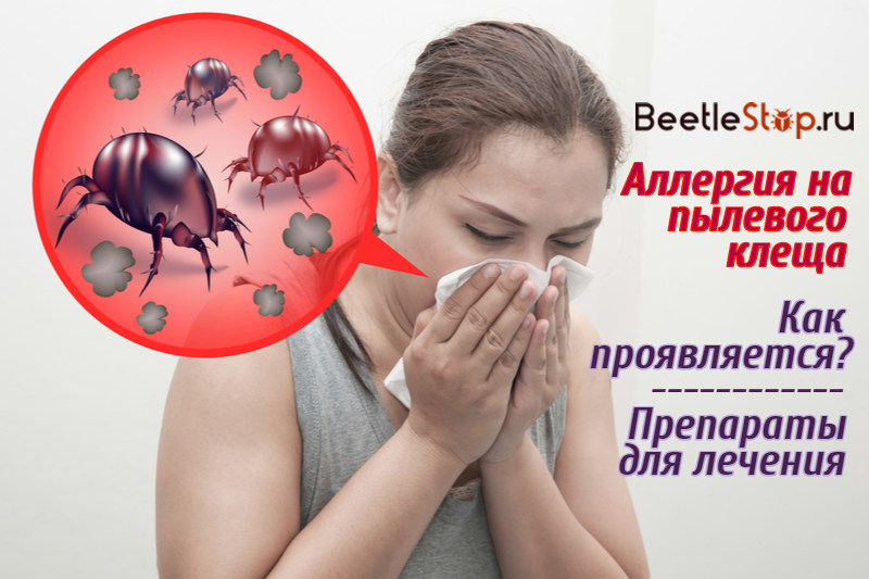 Putekļu ērcītes alerģija